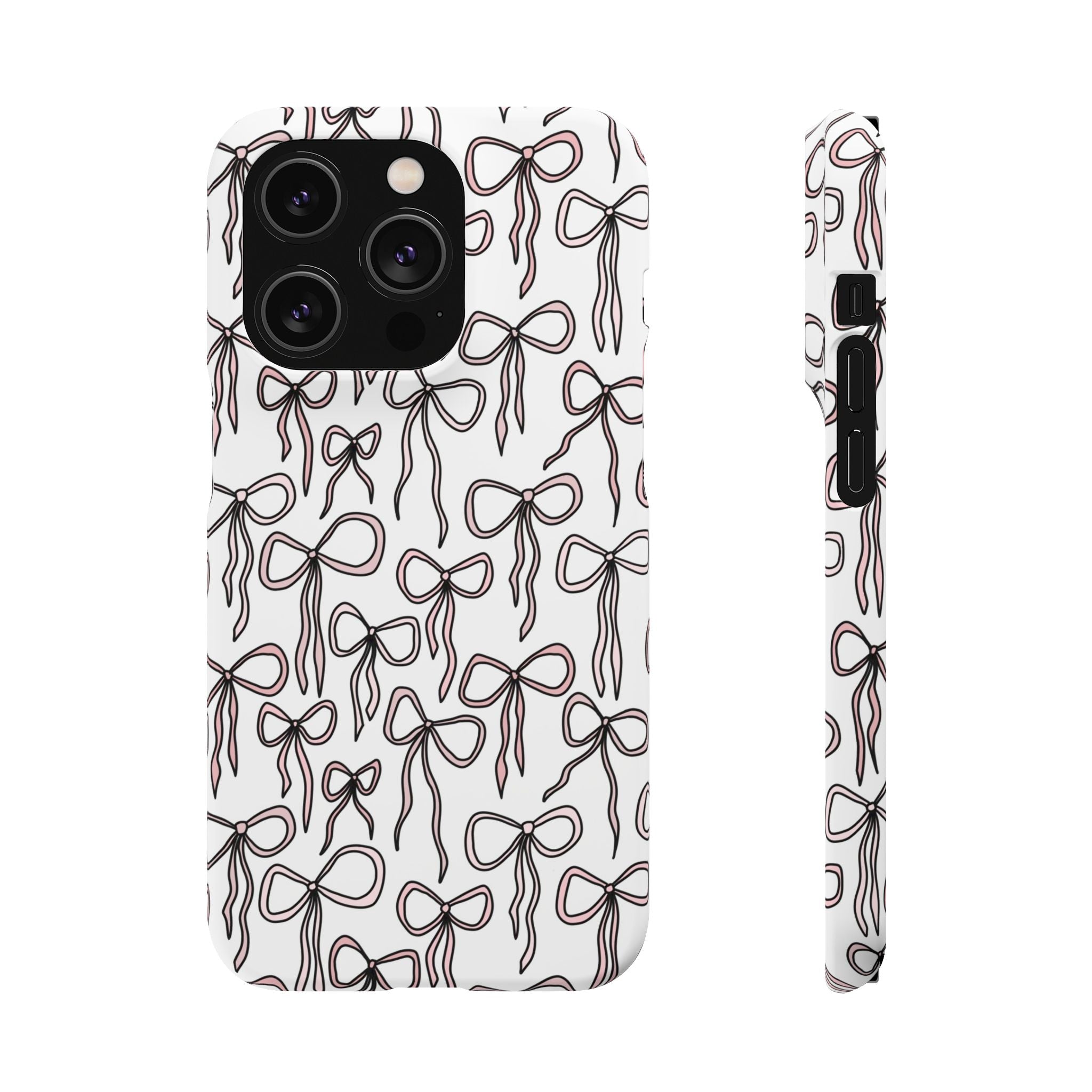 Alexcia Bow Case